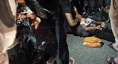 Şanlıurfa'da aracın çarptığı 9 yaşındaki çocuk yaralandı